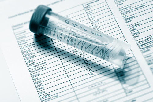 Water Hygiene measurement and purification. Legionella Report